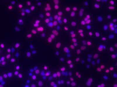 Immunocytochemistry/ Immunofluorescence: RPA2 [p Ser33] Antibody [NB100-544]